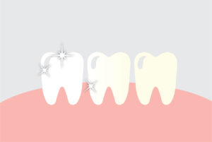 Image depicting brilliantly shining white teeth next to yellow teeth after a teeth whitening procedure. 