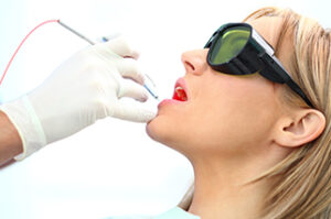 Woman receiving laser dental service. 